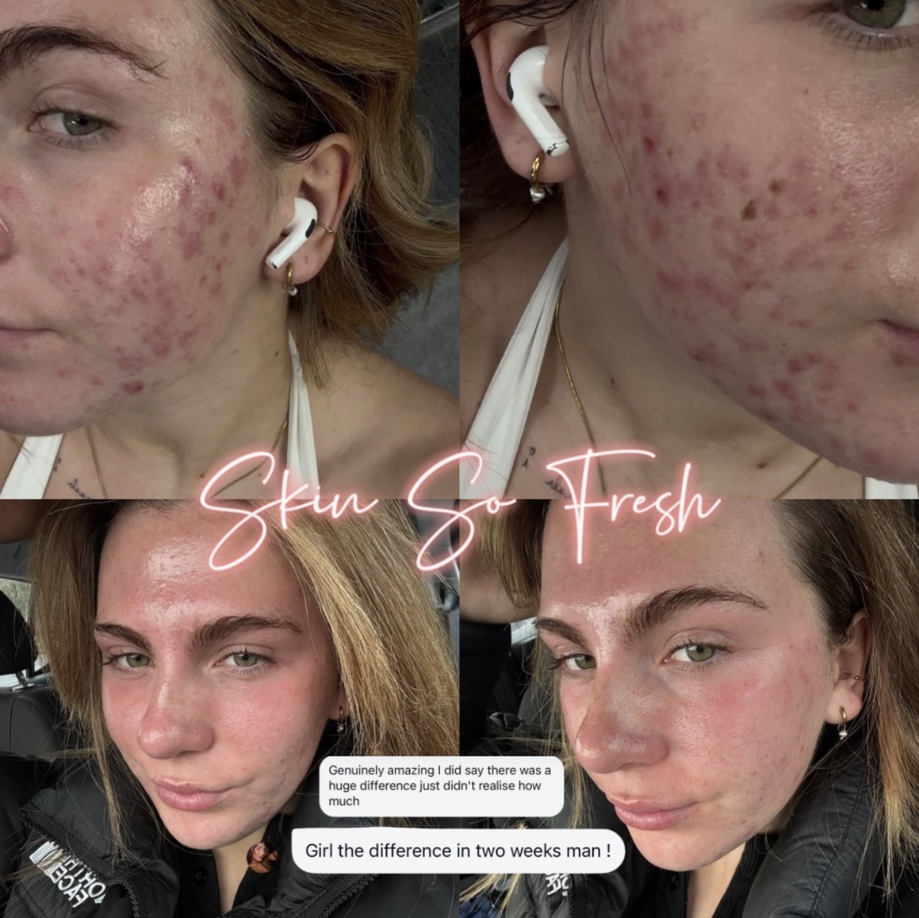Skin So Fresh client skin results
